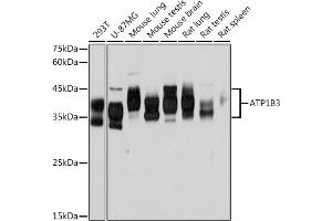 Western blot analysis of extracts of various cell lines, using B3 Rabbit mAb (ABIN7265774) at 1:1000 dilution. (ATP1B3 Antikörper)