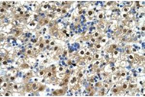 Immunohistochemical staining (Formalin-fixed paraffin-embedded sections) of human liver with GDE1 polyclonal antibody  at 4-8 ug/mL working concentration. (GDE1 Antikörper  (N-Term))