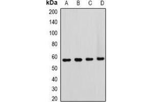 Western blot analysis of HOS expression in Hela (A), NIH3T3 (B), mouse brain (C), rat brain (D) whole cell lysates. (T-Box 5 Antikörper)
