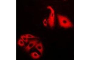 Immunofluorescent analysis of NFS1 staining in Hela cells. (NFS1 Antikörper)