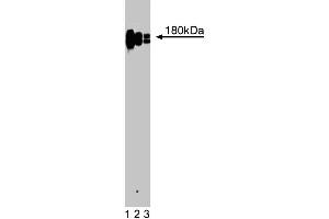 Western blot analysis of CD11a (Integrin alphaL) on a Jurkat cell lysate (Human T-cell leukemia, ATCC TIB-152). (ITGAL Antikörper  (AA 64-199))