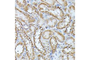 Immunohistochemistry of paraffin-embedded rat kidney using HAL antibody (ABIN6130467, ABIN6141593, ABIN6141594 and ABIN6216851) at dilution of 1:100 (40x lens). (HAL Antikörper  (AA 1-200))