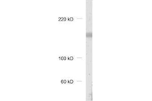 Western Blotting (WB) image for anti-Protein-Kinase, Interferon-Inducible Double Stranded RNA Dependent Inhibitor, Repressor of (p58 Repressor) (PRKRIR) antibody (ABIN2850871)