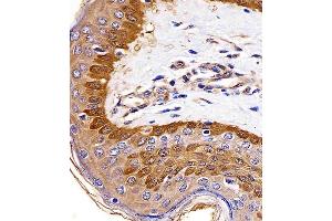 (ABIN6242624 and ABIN6577142) staining S100A2 in human skin tissue sections by Immunohistochemistry (IHC-P - paraformaldehyde-fixed, paraffin-embedded sections). (S100A2 Antikörper)