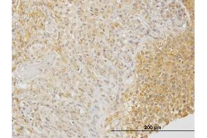 Immunoperoxidase of monoclonal antibody to DPYSL3 on formalin-fixed paraffin-embedded human ovary. (DPYSL3 Antikörper  (AA 457-555))