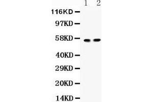 Anti- ICA1 Picoband antibody, Western blotting All lanes: Anti ICA1  at 0. (ICA1 Antikörper  (Middle Region))