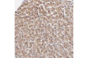 Immunohistochemical staining of human liver with WSB1 polyclonal antibody  shows cytoplasmic and membranous positivity in hepatocytes at 1:50-1:200 dilution. (WSB1 Antikörper)