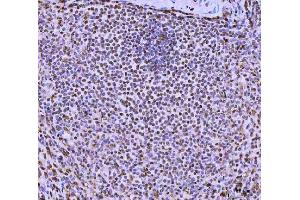 IHC analysis of FIP1L1 using anti-FIP1L1 antibody (ABIN7600761). (FIP1L1 Antikörper  (AA 23-558))