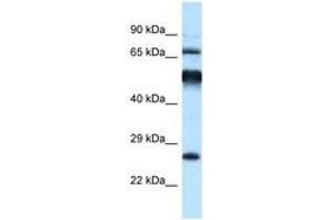 Image no. 1 for anti-Kelch-Like 1 (KLHL1) (AA 396-445) antibody (ABIN6747517) (KLHL1 Antikörper  (AA 396-445))