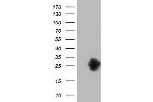 Western Blotting (WB) image for anti-Zinc Finger, AN1-Type Domain 2B (ZFAND2B) antibody (ABIN1501808) (ZFAND2B Antikörper)