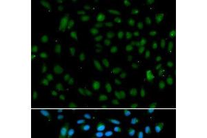 Immunofluorescence analysis of A549 cells using WHSC1L1 Polyclonal Antibody (WHSC1L1 Antikörper)