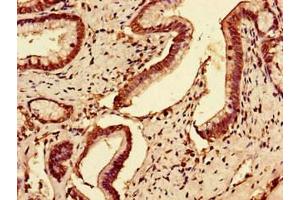 Immunohistochemistry of paraffin-embedded human pancreatic tissue using ABIN7175933 at dilution of 1:100 (SLC7A7 Antikörper  (AA 325-382))