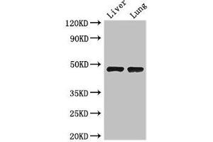 Western Blot Positive WB detected in: Mouse liver tissue, Mouse lung tissue All lanes: SEC14L3 antibody at 3 μg/mL Secondary Goat polyclonal to rabbit IgG at 1/50000 dilution Predicted band size: 47 kDa Observed band size: 47 kDa (SEC14L3 Antikörper  (AA 201-400))