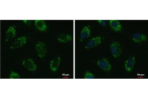 ICC/IF Image UQCRFS1 antibody [N1C3] detects UQCRFS1 protein at mitochondria by immunofluorescent analysis. (UQCRFS1 Antikörper)