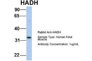 Host: Rabbit Target Name: HADH Sample Type: Human Fetal Muscle Antibody Dilution: 1.