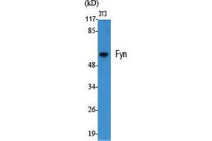 Western Blot (WB) analysis of specific cells using Fyn Polyclonal Antibody. (FYN Antikörper  (Ser400))