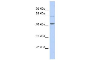 SLC22A12 antibody used at 1 ug/ml to detect target protein. (SLC22A12 Antikörper)