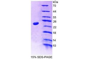 SDS-PAGE (SDS) image for Nucleoporin 35kDa (NUP35) (AA 132-310) protein (His tag) (ABIN2126154) (NUP35 Protein (AA 132-310) (His tag))