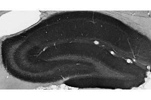 Adult rat hippocampus immunohistochemistry.