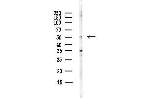 Western blot analysis of lysates from HepG2 cells(starvation,24h treatment), using MMP3 Antibody at 1/1000 dilution.