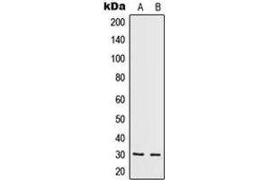Western blot analysis of IL-5 expression in HeLa (A), HepG2 (B) whole cell lysates. (IL-5 Antikörper  (Center))