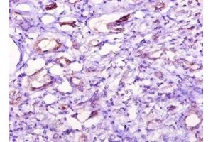 Immunohistochemistry of paraffin-embedded human kidney tissue using ABIN7149376 at dilution of 1:10 (NT5C1A Antikörper  (AA 1-368))