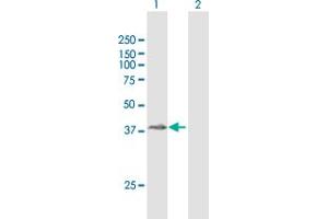 Western Blot analysis of ZPBP2 expression in transfected 293T cell line by ZPBP2 MaxPab polyclonal antibody. (ZPBP2 Antikörper  (AA 1-315))