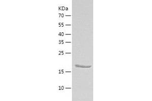 Western Blotting (WB) image for CASP2 and RIPK1 Domain Containing Adaptor with Death Domain (CRADD) (AA 1-199) protein (His-IF2DI Tag) (ABIN7122159)
