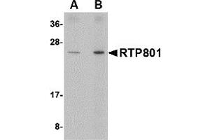 Western Blotting (WB) image for anti-DNA-Damage-Inducible Transcript 4 (DDIT4) (Middle Region) antibody (ABIN1031074) (DDIT4 Antikörper  (Middle Region))