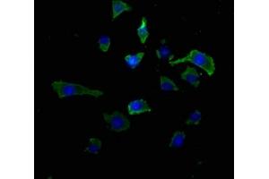 Immunofluorescence staining of SH-SY5Y cells with ABIN7167314 at 1:50, counter-stained with DAPI. (RAB39A Antikörper  (AA 1-217))