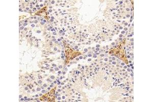 Immunohistochemistry analysis of paraffin-embedded mouse tumor using,INSL3 (ABIN7074302) at dilution of 1: 3000