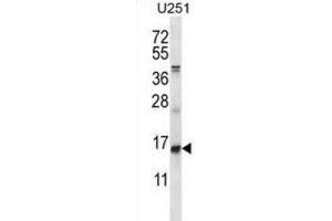 Western Blotting (WB) image for anti-Inhibitor of DNA Binding 1, Dominant Negative Helix-Loop-Helix Protein (ID1) antibody (ABIN2996340) (ID1 Antikörper)