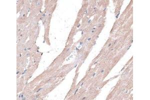 Immunohistochemistry of paraffin-embedded Mouse heart using PPT2 Polyclonal Antibody at dilution of 1:100 (40x lens). (PPT2 Antikörper)