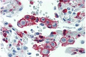 Lung, Human: Formalin-Fixed, Paraffin-Embedded (FFPE) (Integrin beta 2 Antikörper  (AA 534-546))