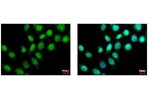 ICC/IF Image BS69 antibody detects ZMYND11 protein at nucleus by immunofluorescent analysis. (ZMYND11 Antikörper)