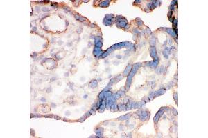 IHC analysis of Integrin alpha 4 using anti-Integrin alpha 4 antibody (ABIN3043255).