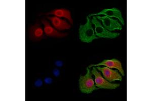 ABIN6265935 and ABIN6277190 staining Hela cells by IF/ICC.