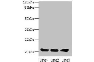 Western blot All lanes: PLLP antibody at 4 μg/mL Lane 1: Mouse gonadal tissue Lane 2: Mouse kidney tissue Lane 3: Mouse lung tissue Secondary Goat polyclonal to rabbit IgG at 1/10000 dilution Predicted band size: 20 kDa Observed band size: 20 kDa (Plasmolipin Antikörper  (AA 1-35))