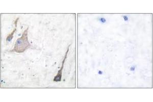 Immunohistochemistry analysis of paraffin-embedded human brain tissue, using Synuclein-pan Antibody. (Synuclein Antikörper  (AA 15-64))