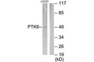 Western blot analysis of extracts from LOVO cells, using Breast Tumor Kinase Antibody. (PTK6 Antikörper  (AA 10-59))