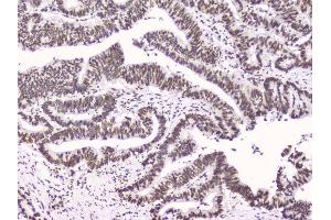 IHC analysis of RbAp48 using anti-RbAp48 antibody (ABIN5692929).