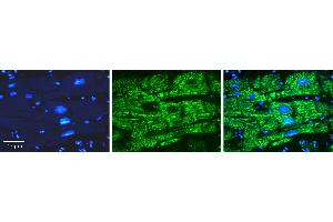 Rabbit Anti-OPTN Antibody   Formalin Fixed Paraffin Embedded Tissue: Human heart Tissue Observed Staining: Cytoplasmic Primary Antibody Concentration: N/A Other Working Concentrations: 1:600 Secondary Antibody: Donkey anti-Rabbit-Cy3 Secondary Antibody Concentration: 1:200 Magnification: 20X Exposure Time: 0.