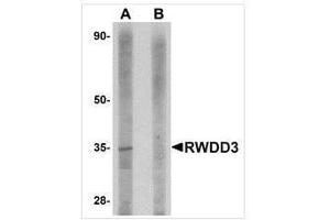 Western blot analysis of RWDD3 in rat kidney tissue lysate with RWDD3 antibody at 1 μg/ml in (A) the absence and (B) the presence of blocking peptide. (RWDD3 Antikörper  (C-Term))
