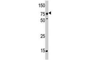 Western blot analysis of SCYL2 polyclonal antibody  in T-47D . (SCYL2 Antikörper  (C-Term))