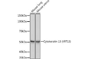 Western blot analysis of extracts of various cell lines, using Cytokeratin 13 (KRT13) (KRT13) Rabbit mAb (ABIN7268089) at 1:1000 dilution. (Cytokeratin 13 Antikörper)