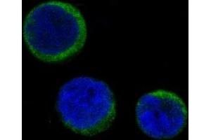 Immunofluorescent analysis of Jurkat cells, using Ferritin Antibody. (Rekombinanter Ferritin Antikörper)