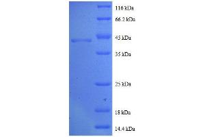 SDS-PAGE (SDS) image for Cytidine Deaminase (CDA) (AA 1-146), (full length) protein (GST tag) (ABIN618727)