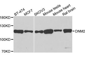Western blot analysis of extracts of various cells, using DNM2 antibody. (DNM2 Antikörper)