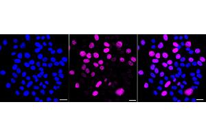 anti-Kinesin Family Member C1 (KIFC1) antibody