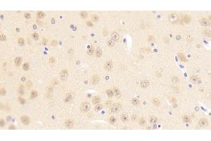 Detection of PCDHb2 in Mouse Cerebrum Tissue using Polyclonal Antibody to Protocadherin Beta 2 (PCDHb2) (PCDHb2 Antikörper  (AA 79-253))